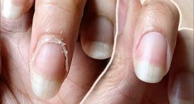 What are cuticles?