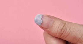 Why do nails peel off?